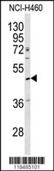 SERPINA4 Antibody (C-term)