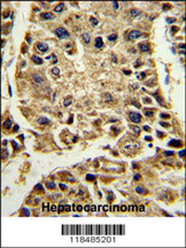 SERPINA4 Antibody (C-term)