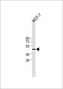IDH1 Antibody (Center)