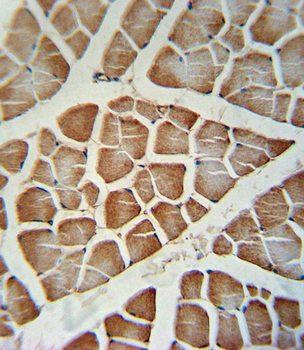 CYP2J2 Antibody (Center)