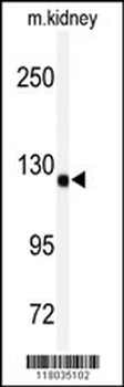 ADAMTS19 Antibody (Center)