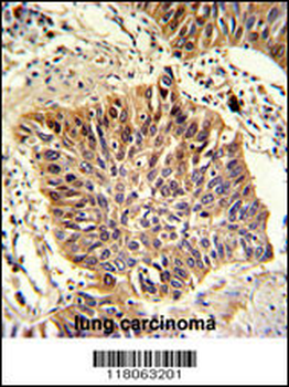 GOLPH3 Antibody (C-term)