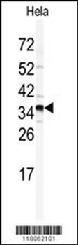 GOLPH3 Antibody (N-term)