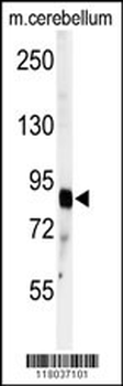 ADAMTS4 Antibody (C-term)