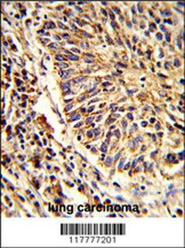 ADAM9 Antibody (C-term)