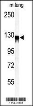 VINC Antibody (N-term)