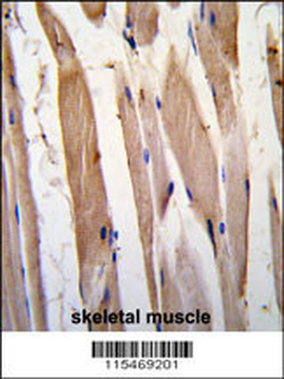 VINC Antibody (N-term)