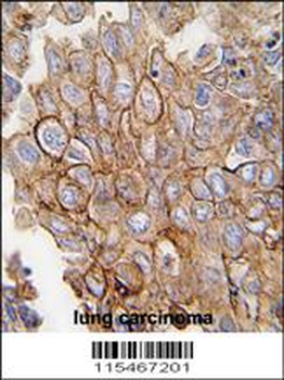ANXA2 Antibody (C-term)