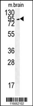 GIT1-S388 Antibody (Center)