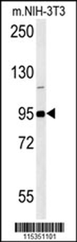 GIT1 (Y554) Antibody (C-term)