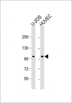 GIT1 (Y554) Antibody (C-term)