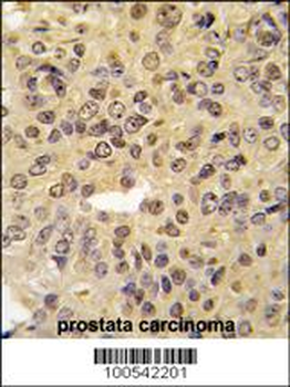 MEN1 Antibody (S128)