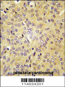 LARS Antibody (C-term)