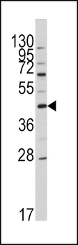 APOA5 Antibody (N-term)