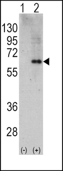 AMPK alpha2 (PRKAA2) Antibody (C-term)
