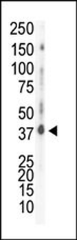 CSNK1D Antibody (C-term)