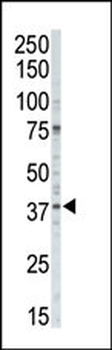 CSNK1A1 Antibody (C-term)