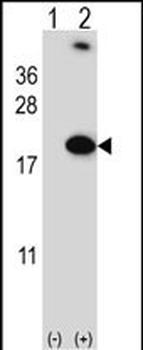 RBM3 Antibody (Center)