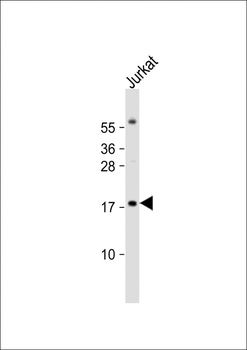 RBM3 Antibody (Center)