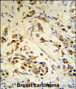 RBM3 Antibody (Center)