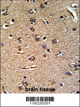 GGTLA1 Antibody (N-term)