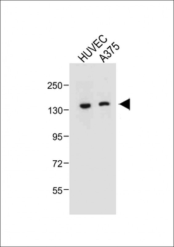 TECPR1 Antibody (C-term)