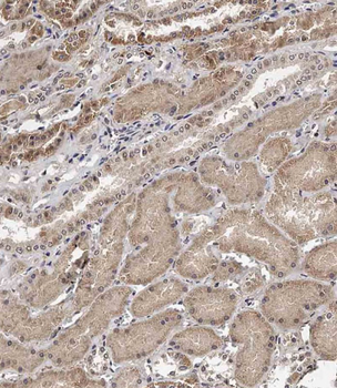 TECPR1 Antibody (C-term)