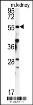 FKBP9 Antibody (N-term)