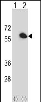 FKBP4 Antibody (Center)