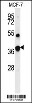FBP1 Antibody (Center)