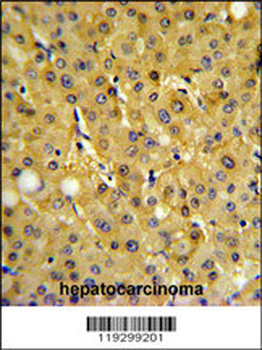 FBP1 Antibody (Center)