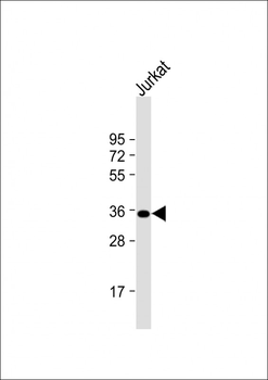 FBP1 Antibody (N-term)