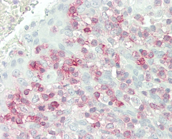 FKBP10 Antibody (C-term)