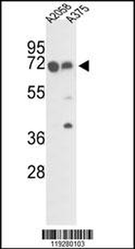 FKBP10 Antibody (C-term)
