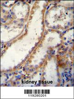 FKBP10 Antibody (C-term)