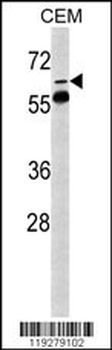 FKBP10 Antibody (N-term)