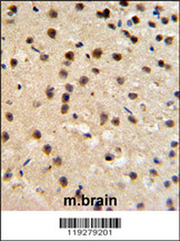 FKBP10 Antibody (N-term)