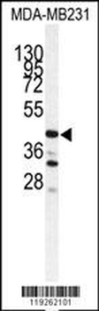 CTSS Antibody (Center)