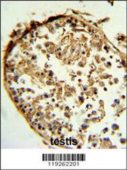 CTSS Antibody (Center)