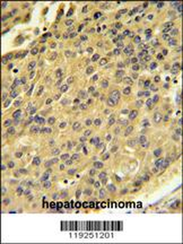 CTSH Antibody (N-term)