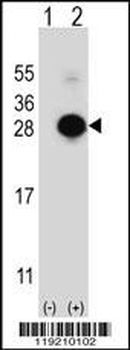MOBKL1B Antibody (C-term)