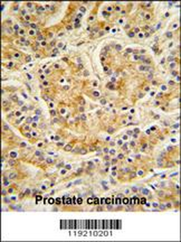 MOBKL1B Antibody (C-term)