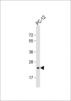 Mouse DHFR Antibody (C-term)