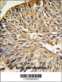 Mouse DHFR Antibody (C-term)