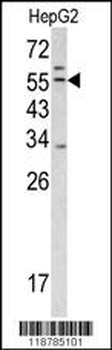 TMPRSS2 Antibody (Center)