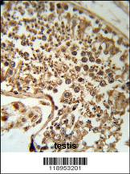 SERPINH1 Antibody (C-term)