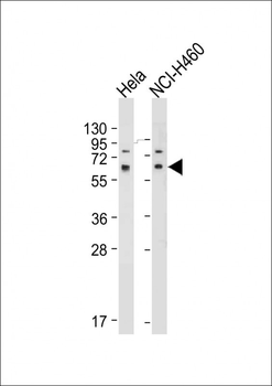SMAD2 Antibody (T220)