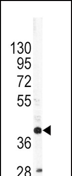 APOL1 Antibody (C-term)