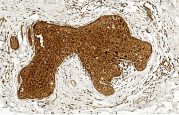 BCOR Antibody (Center S1122)