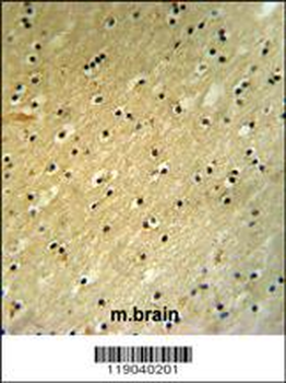 BCOR Antibody (Center S1122)